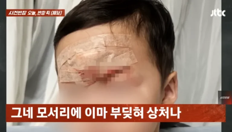 세종 키즈카페에서 철심이 노출된 놀이기구로 인해 아동이 머리를 크게 다쳤다.