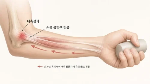팔꿈치 안쪽의 내측상과와 손목 굽힘근 힘줄이 연결되는 위치