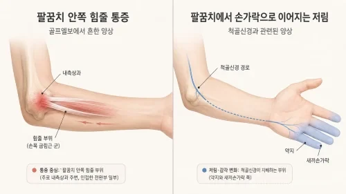 골프엘보 통증