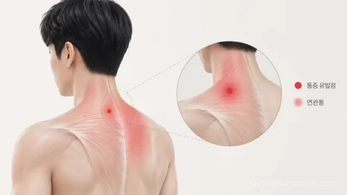 통증 유발점