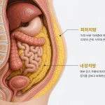 내장지방과 피하지방의 위치를 보여주는 인체 단면도