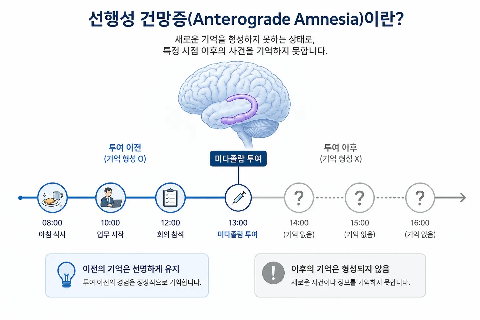약물 투여 후 기억이 사라지는 선행성 건망 개념도