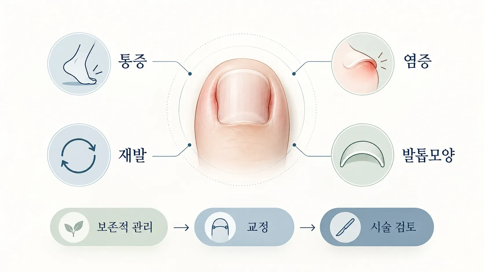 내성발톱은 초기 압박감과 통증에서 시작해 붓기와 발적이 나타날 수 있으며, 증상이 진행되면 진물이나 고름이 동반될 수 있다. (사진=생성형AI)
